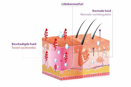 BAPSCARCARE werking – normale vs beschadigde huid