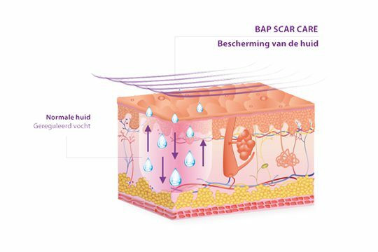 BAPSCARCARE werking siliconenpleisters